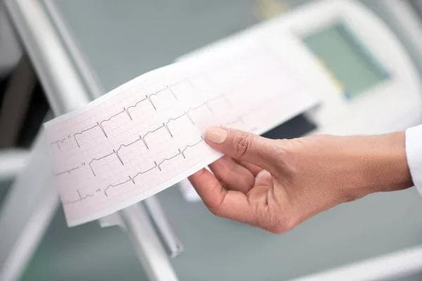 Kardiologischer Check-up