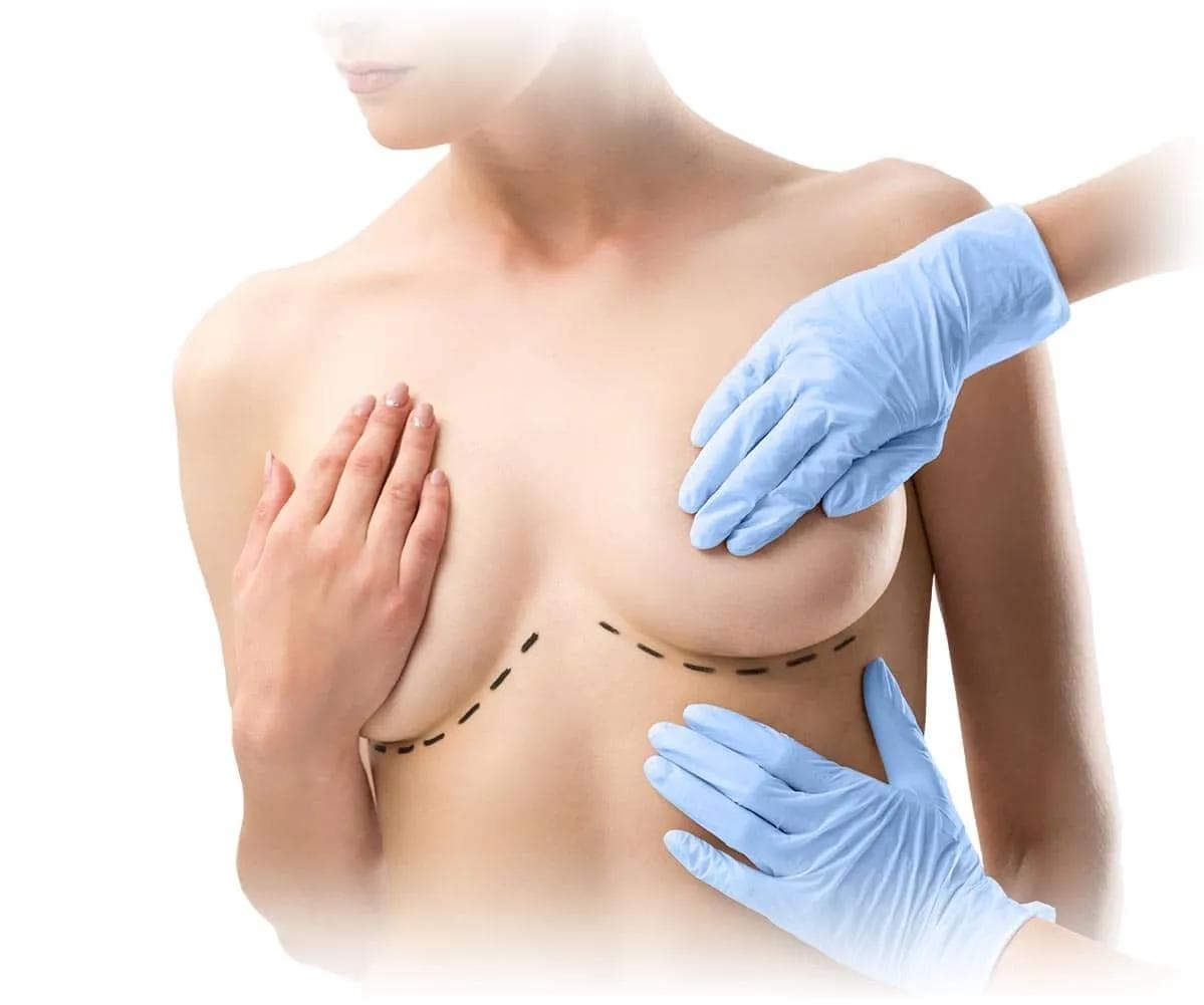 Breast Surgery in Turkey