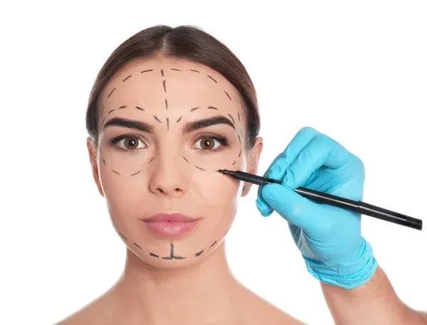 Facelift Surgery