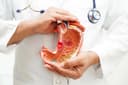 Sleeve Gastrectomy Revision Surgery