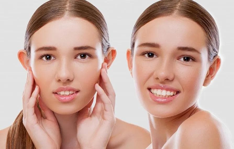 Otoplasty (Cosmetic Ear Surgery)