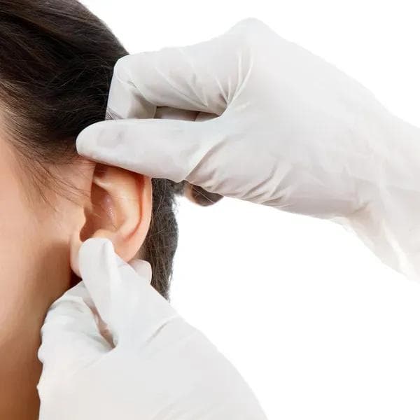 Otoplastie esthétique