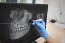 Panoramik Dental X-Işını