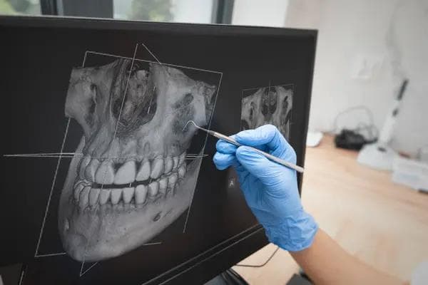 Panoramik Dental X-Işını