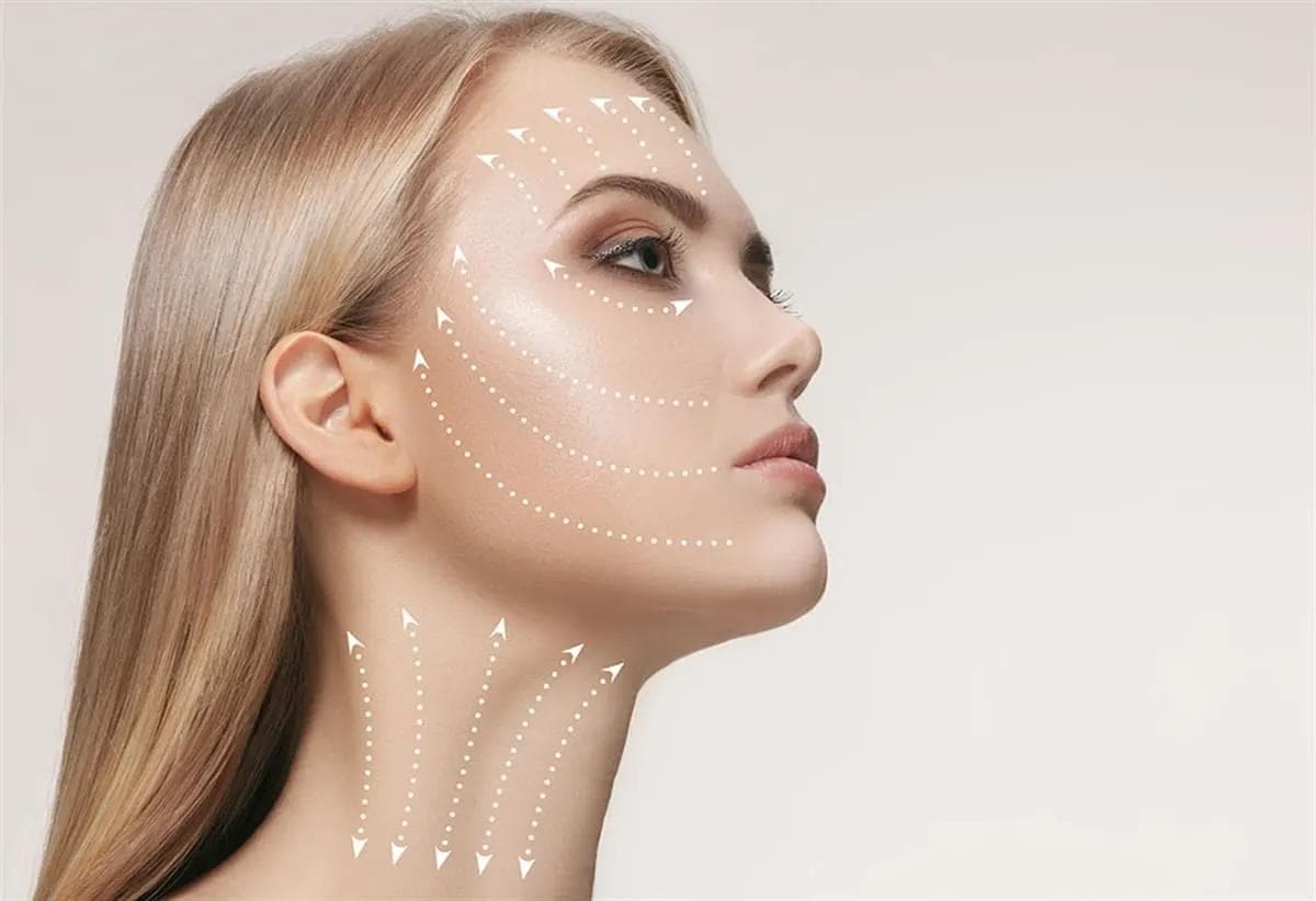 Facelift Surgery